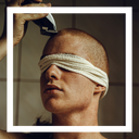 What Is Alopecia: The Types And Causes