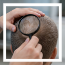 An Honest Look at Hair Transplant Surgery: Part 1 of 2
