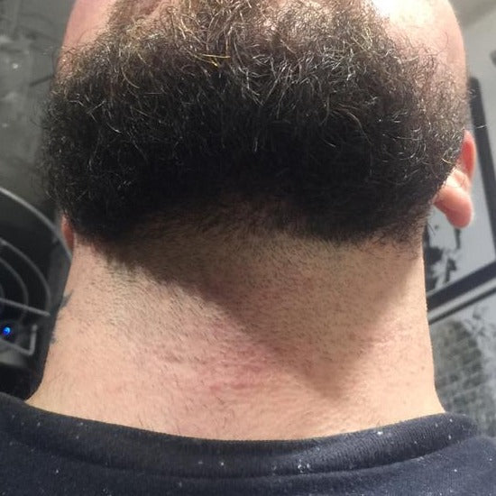 Underside of the same beard after eight months of DEKOBEARD use