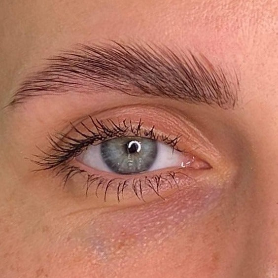 The same brow after consistent DEKOBROW use