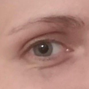 Brow before DEKOBROW use