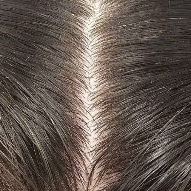 Female part line before DEKOHAIR use