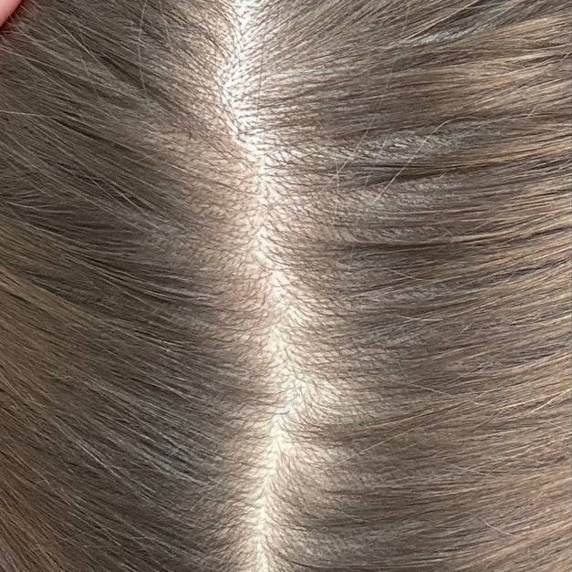 Female crown before DEKOHAIR use