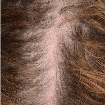 Female part line before DEKOHAIR use