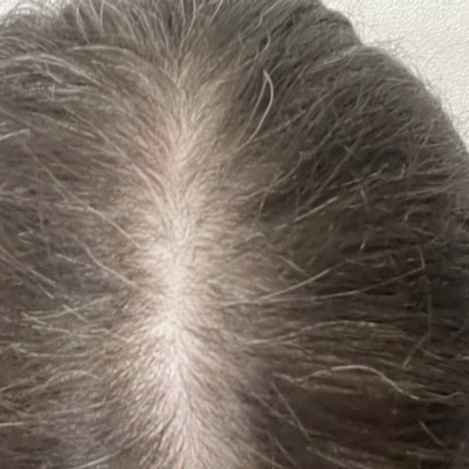 Female part line before DEKOHAIR use
