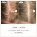 DEKOHAIR 6-Month Bundle