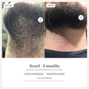 DEKOBEARD 30mL