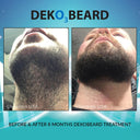 DEKOBEARD 30mL